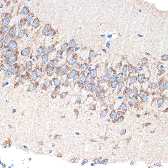 PAK3 Rabbit Monoclonal Antibody - Image 3