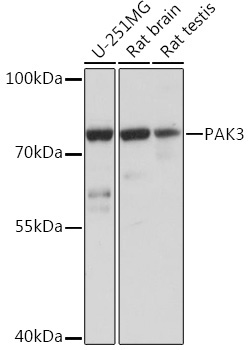 PAK3 Rabbit Polyclonal Antibody