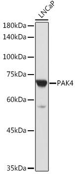 PAK4 Rabbit Polyclonal Antibody