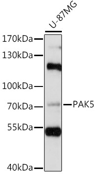 PAK5 Rabbit Polyclonal Antibody