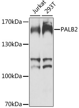 PALB2 Rabbit Polyclonal Antibody