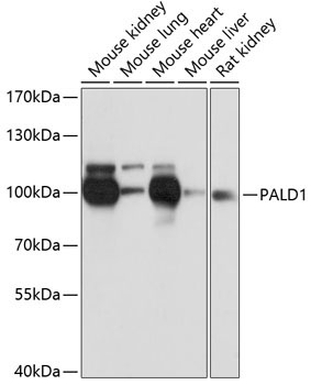 PALD1 Rabbit Polyclonal Antibody