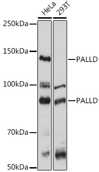 PALLD Rabbit Polyclonal Antibody