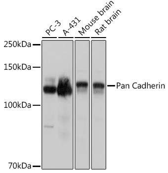 Pan Cadherin Rabbit Polyclonal Antibody