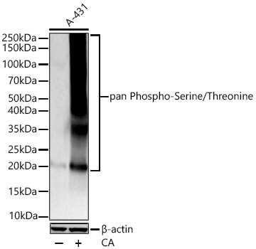 pan Phospho-Serine/Threonine Mouse Monoclonal Antibody - Image 2