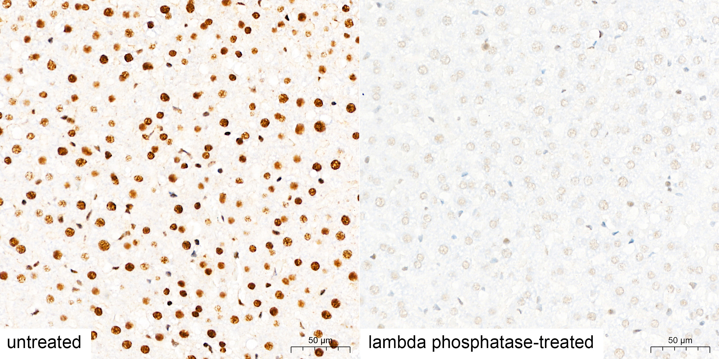 pan Phospho-Serine/Threonine Mouse Monoclonal Antibody - Image 3