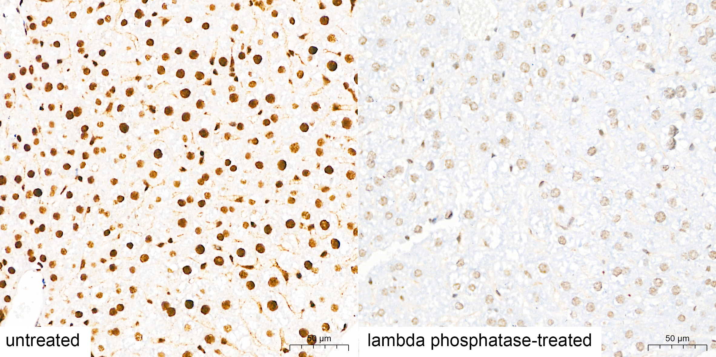 pan Phospho-Serine/Threonine Mouse Monoclonal Antibody - Image 4