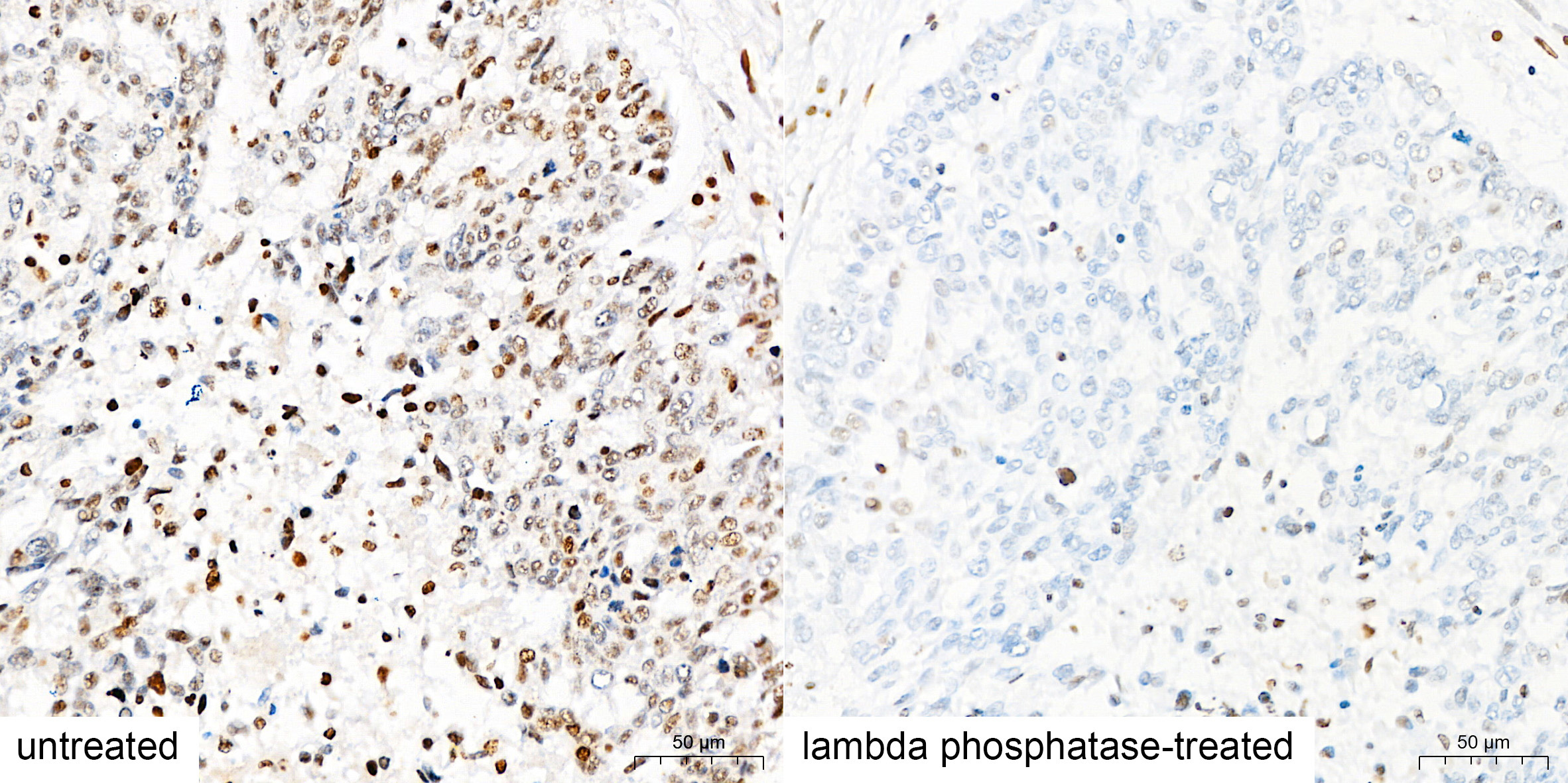pan Phospho-Serine/Threonine Mouse Monoclonal Antibody - Image 5
