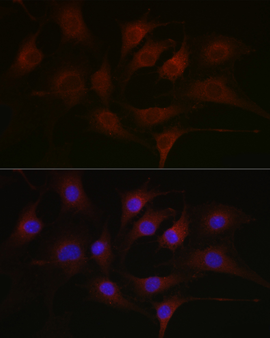 Pan Phospho-Tyrosine Mouse Monoclonal Antibody - Image 4