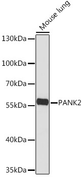 PANK2 Rabbit Polyclonal Antibody