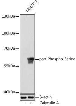 pan-Phospho-Serine Rabbit Polyclonal Antibody