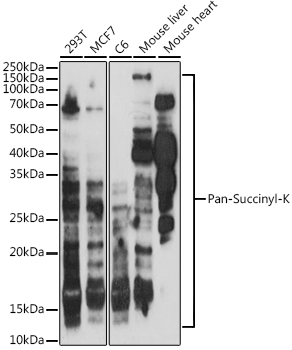 Pan-Succinyl-K Rabbit Polyclonal Antibody