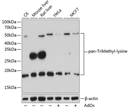 pan-TriMethyl-lysine Rabbit Polyclonal Antibody