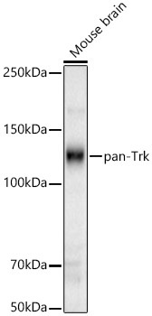 pan-Trk Rabbit Polyclonal Antibody
