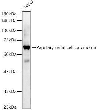 Papillary renal cell carcinoma Rabbit Polyclonal Antibody