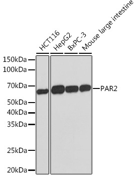 PAR2 Rabbit Monoclonal Antibody