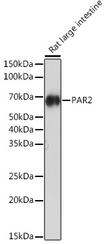 PAR2 Rabbit Monoclonal Antibody - Image 2