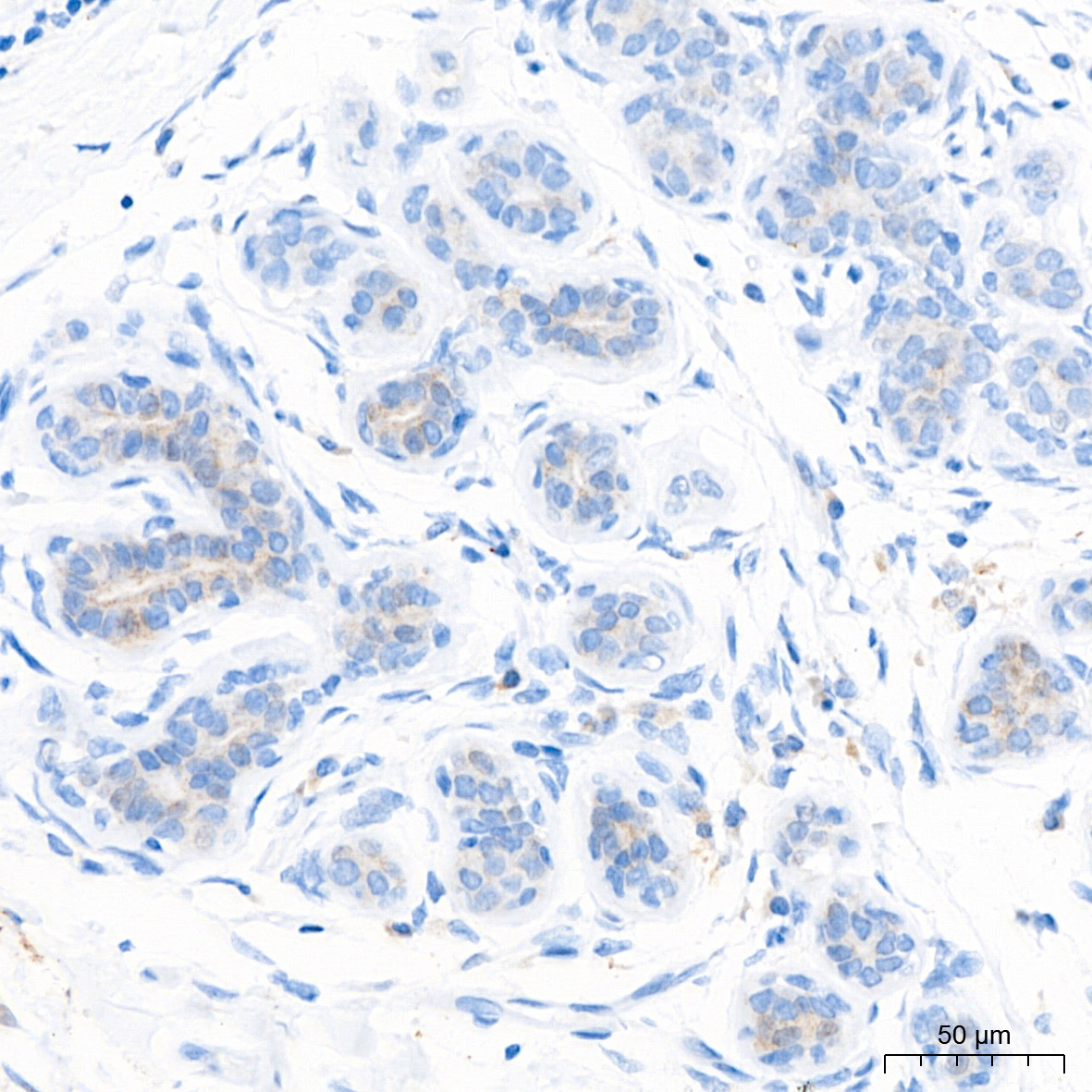 PAR2 Rabbit Monoclonal Antibody - Image 3