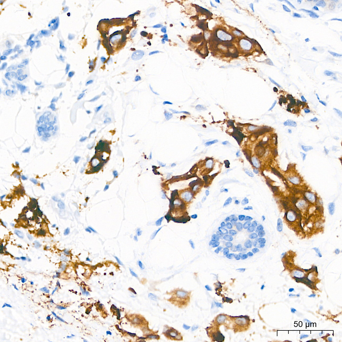 PAR2 Rabbit Monoclonal Antibody - Image 4