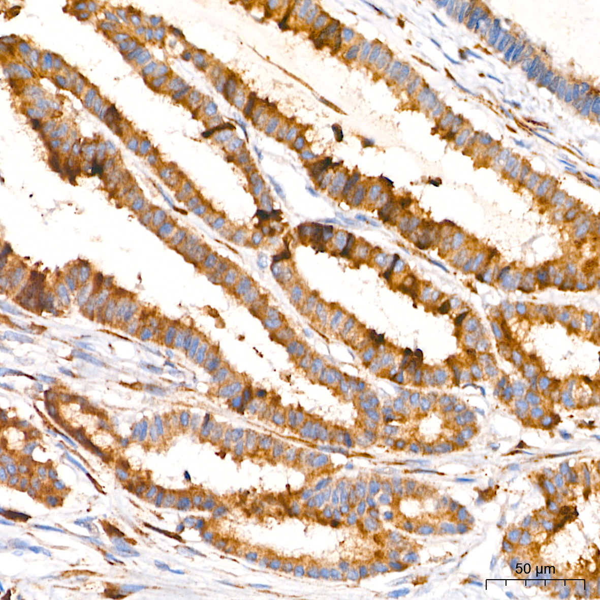 PAR2 Rabbit Monoclonal Antibody - Image 5