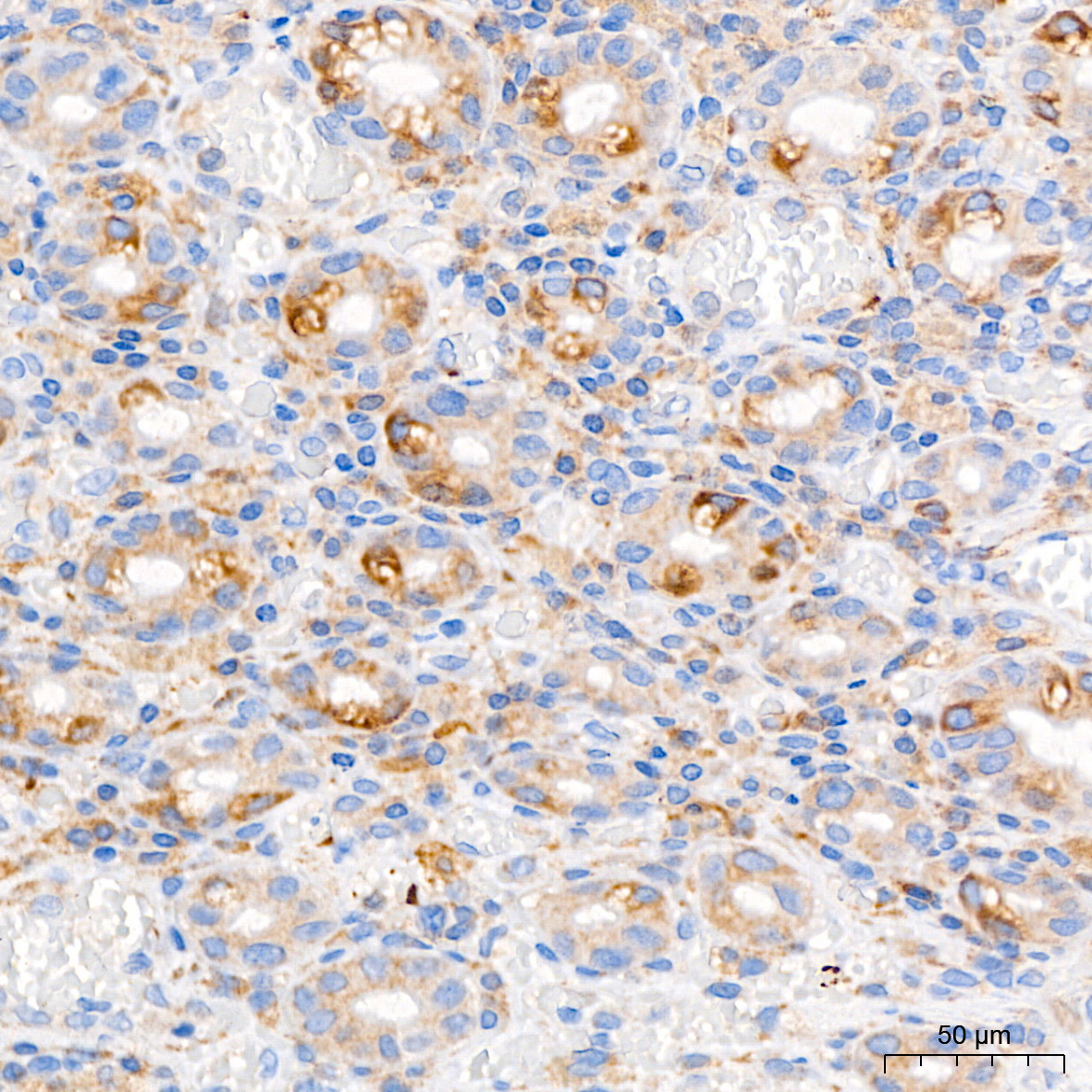PAR2 Rabbit Monoclonal Antibody - Image 6