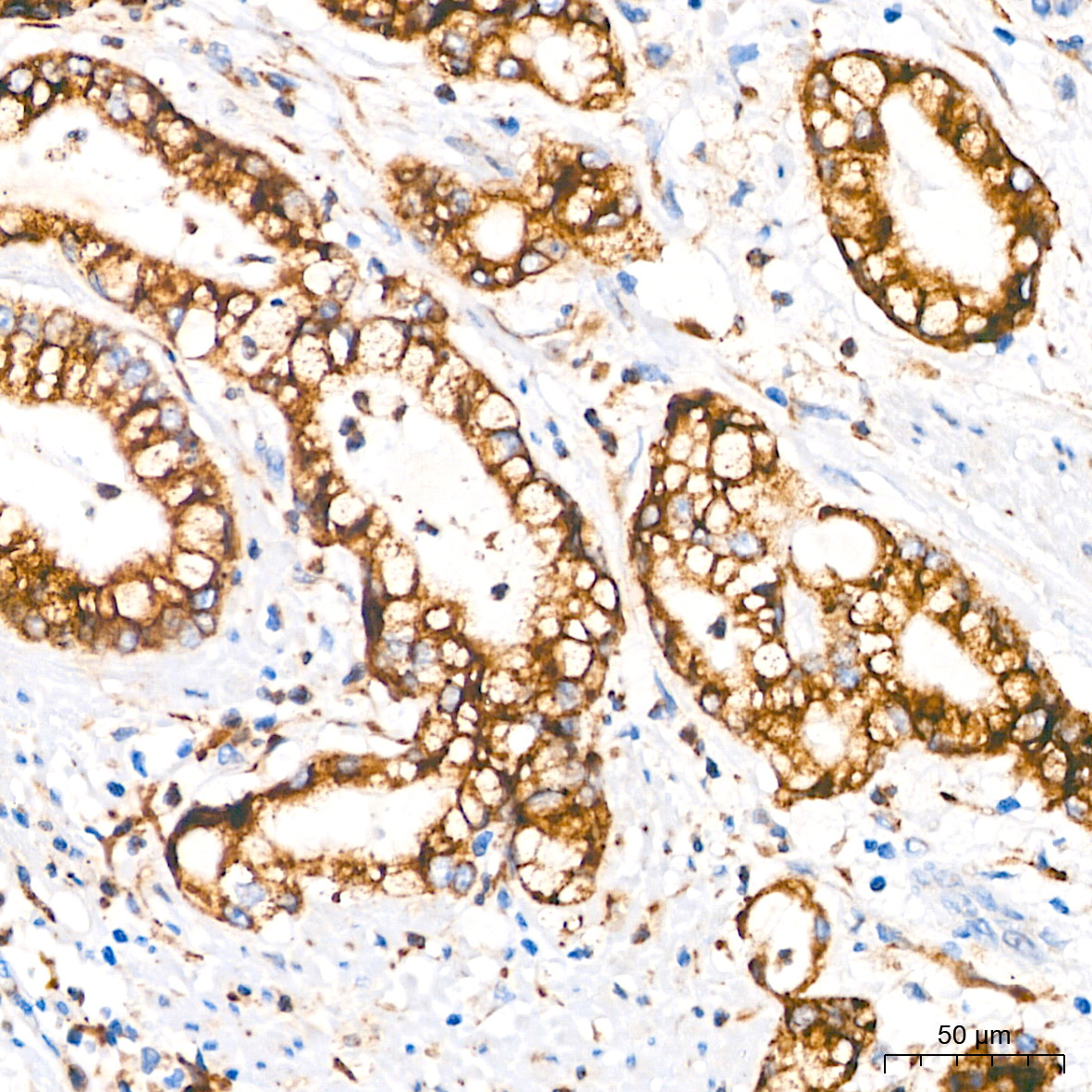 PAR2 Rabbit Monoclonal Antibody - Image 7