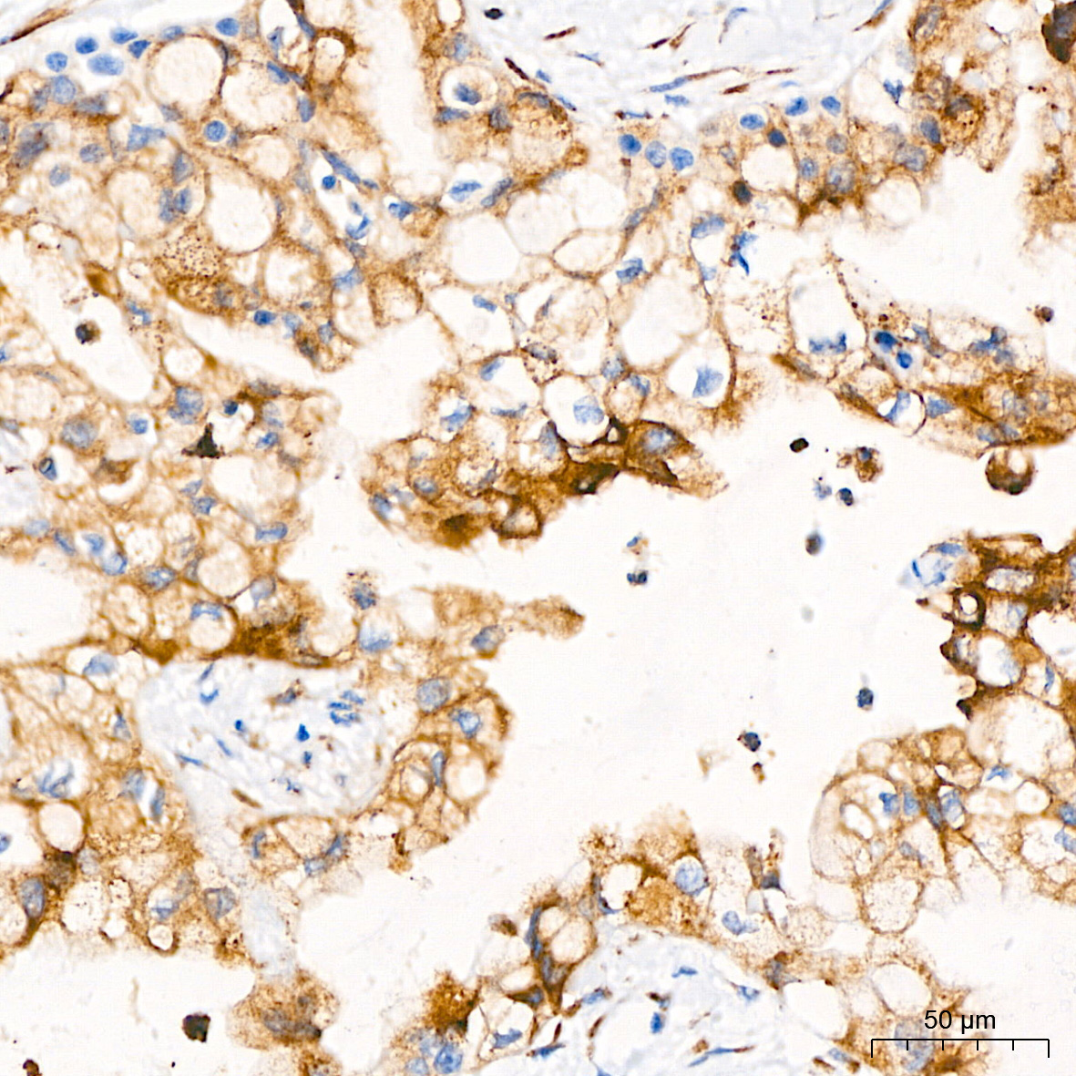 PAR2 Rabbit Monoclonal Antibody - Image 8