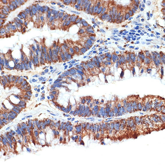 PAR4 Rabbit Monoclonal Antibody - Image 2