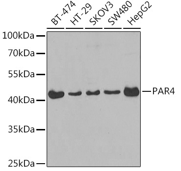 PAR4 Rabbit Polyclonal Antibody