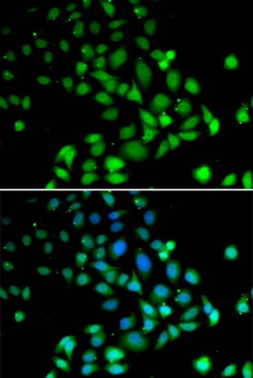 PARN Rabbit Polyclonal Antibody - Image 2