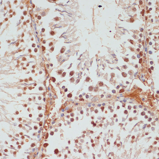 PARP1 Rabbit Polyclonal Antibody