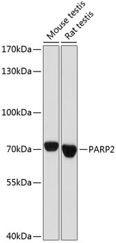 PARP2 Rabbit Polyclonal Antibody