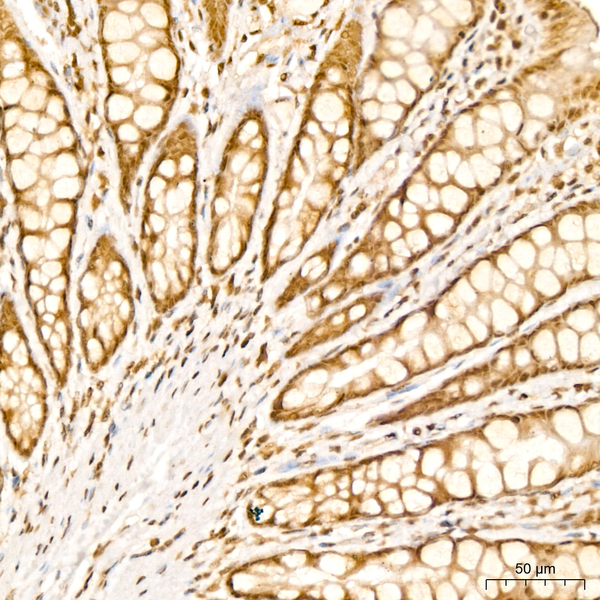 PARP3 Rabbit Polyclonal Antibody - Image 2