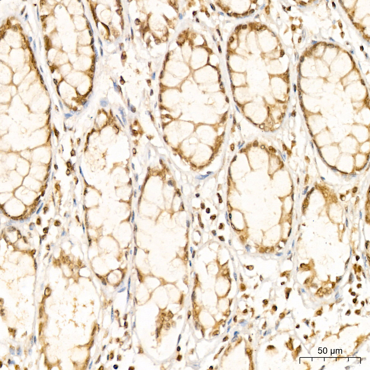 PARP3 Rabbit Polyclonal Antibody - Image 3