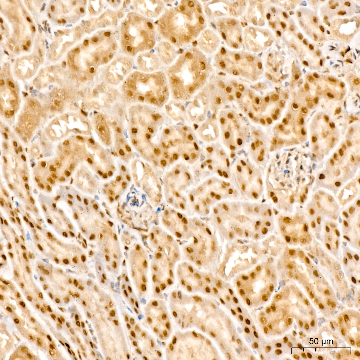 PARP3 Rabbit Polyclonal Antibody - Image 4