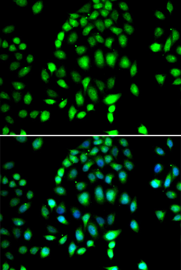 PARP3 Rabbit Polyclonal Antibody - Image 5