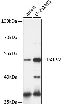 PARS2 Rabbit Polyclonal Antibody