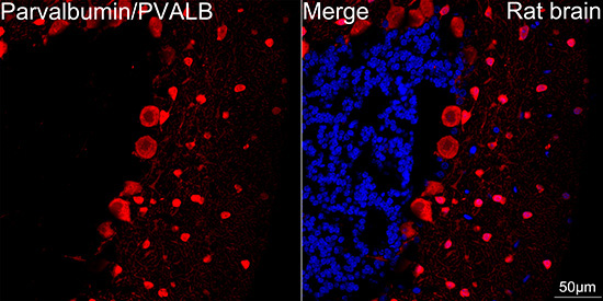 Parvalbumin/PVALB Rabbit Monoclonal Antibody - Image 2