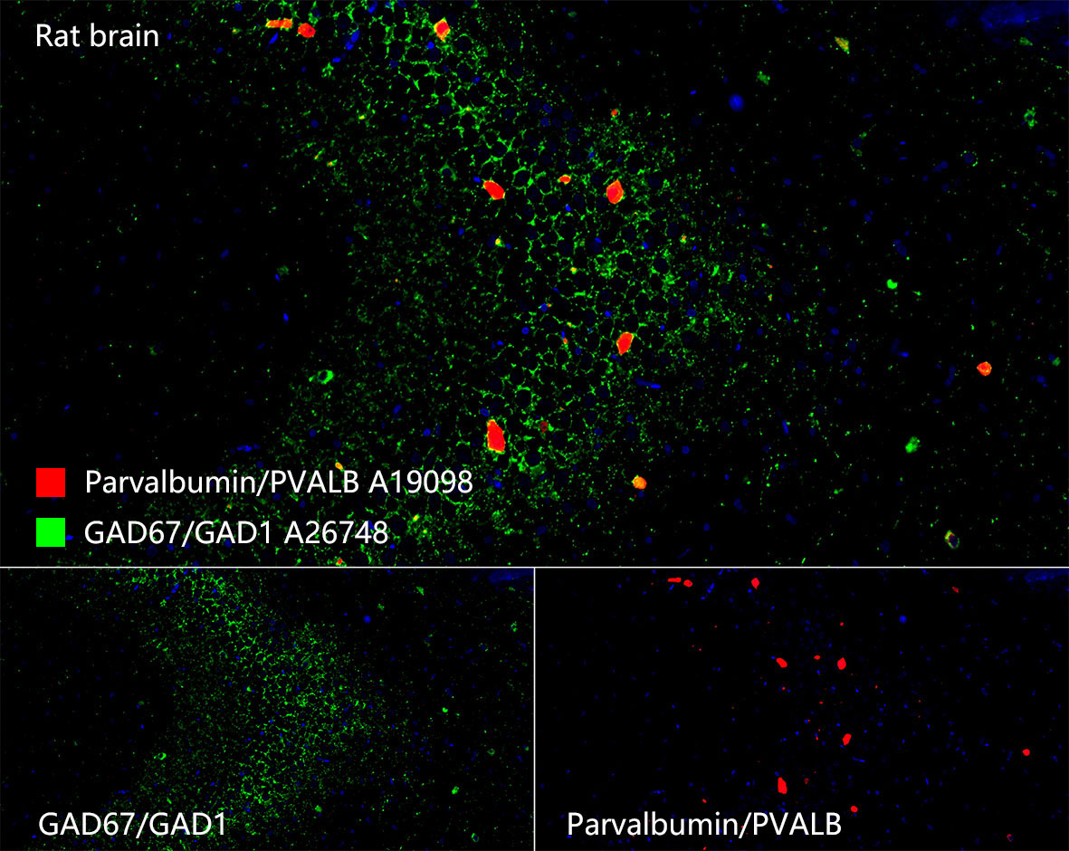 Parvalbumin/PVALB Rabbit Monoclonal Antibody - Image 3