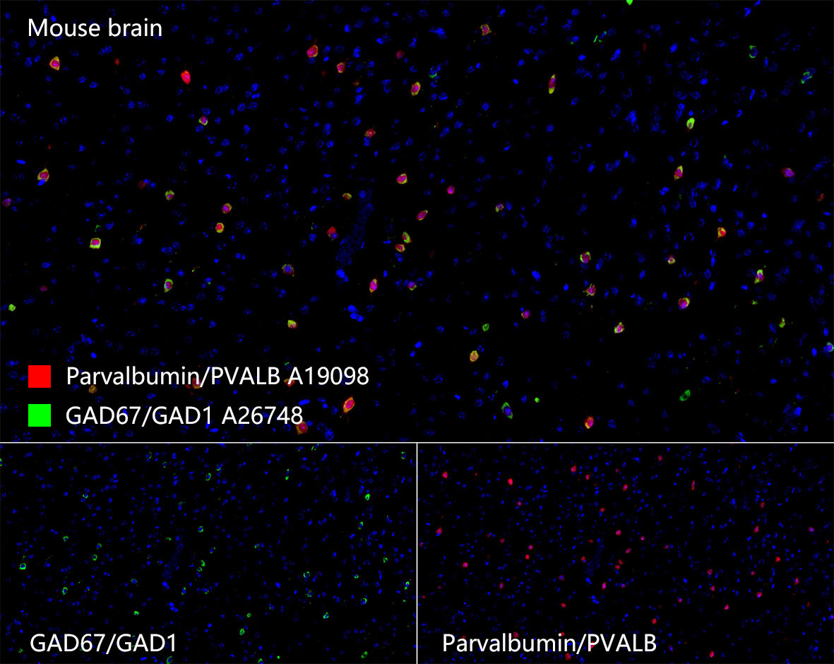 Parvalbumin/PVALB Rabbit Monoclonal Antibody - Image 4