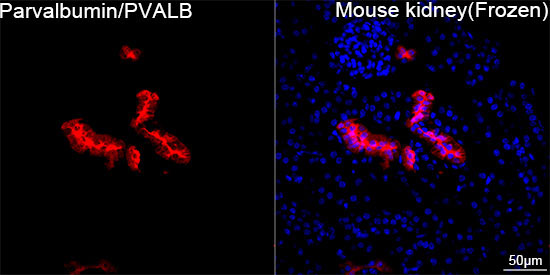 Parvalbumin/PVALB Rabbit Monoclonal Antibody - Image 5