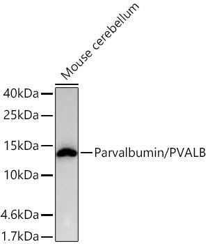Parvalbumin/PVALB Rabbit Monoclonal Antibody - Image 7