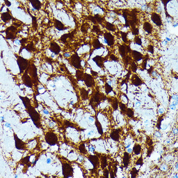 Parvalbumin/PVALB Rabbit Monoclonal Antibody - Image 8