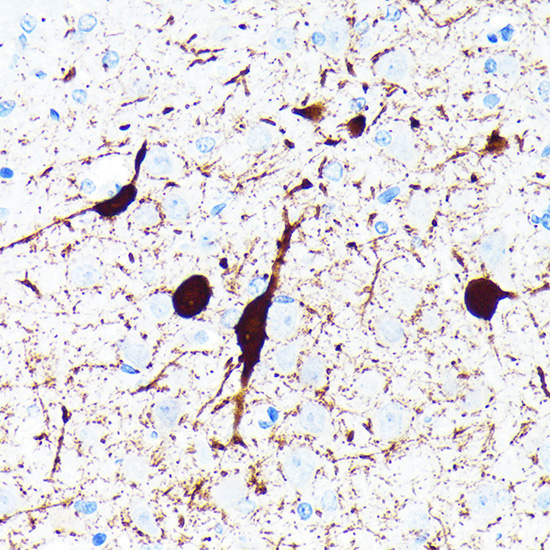 Parvalbumin/PVALB Rabbit Monoclonal Antibody - Image 9