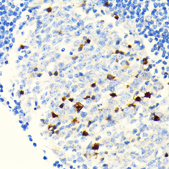 Parvalbumin/PVALB Rabbit Monoclonal Antibody - Image 10