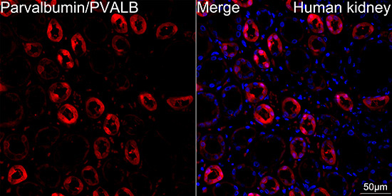 Parvalbumin/PVALB Rabbit Monoclonal Antibody - Image 12