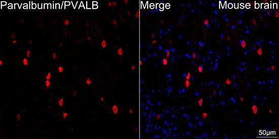 Parvalbumin/PVALB Rabbit Monoclonal Antibody - Image 13