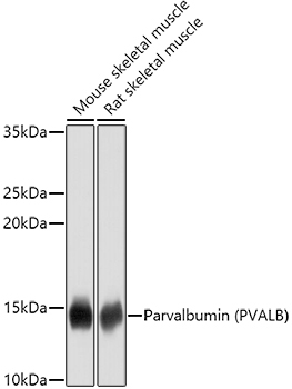 Parvalbumin/PVALB Rabbit Polyclonal Antibody