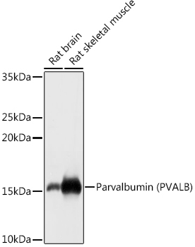 Parvalbumin/PVALB Rabbit Polyclonal Antibody