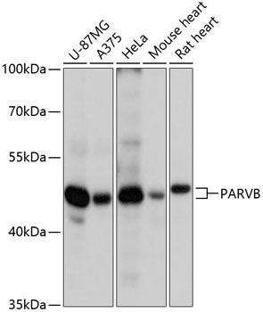 PARVB Rabbit Polyclonal Antibody
